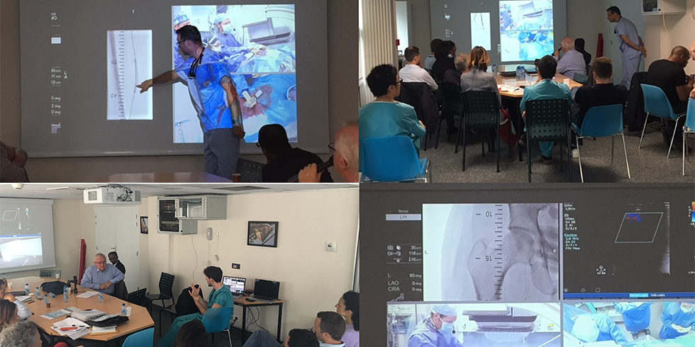 atelier sur angioplastie périphérique