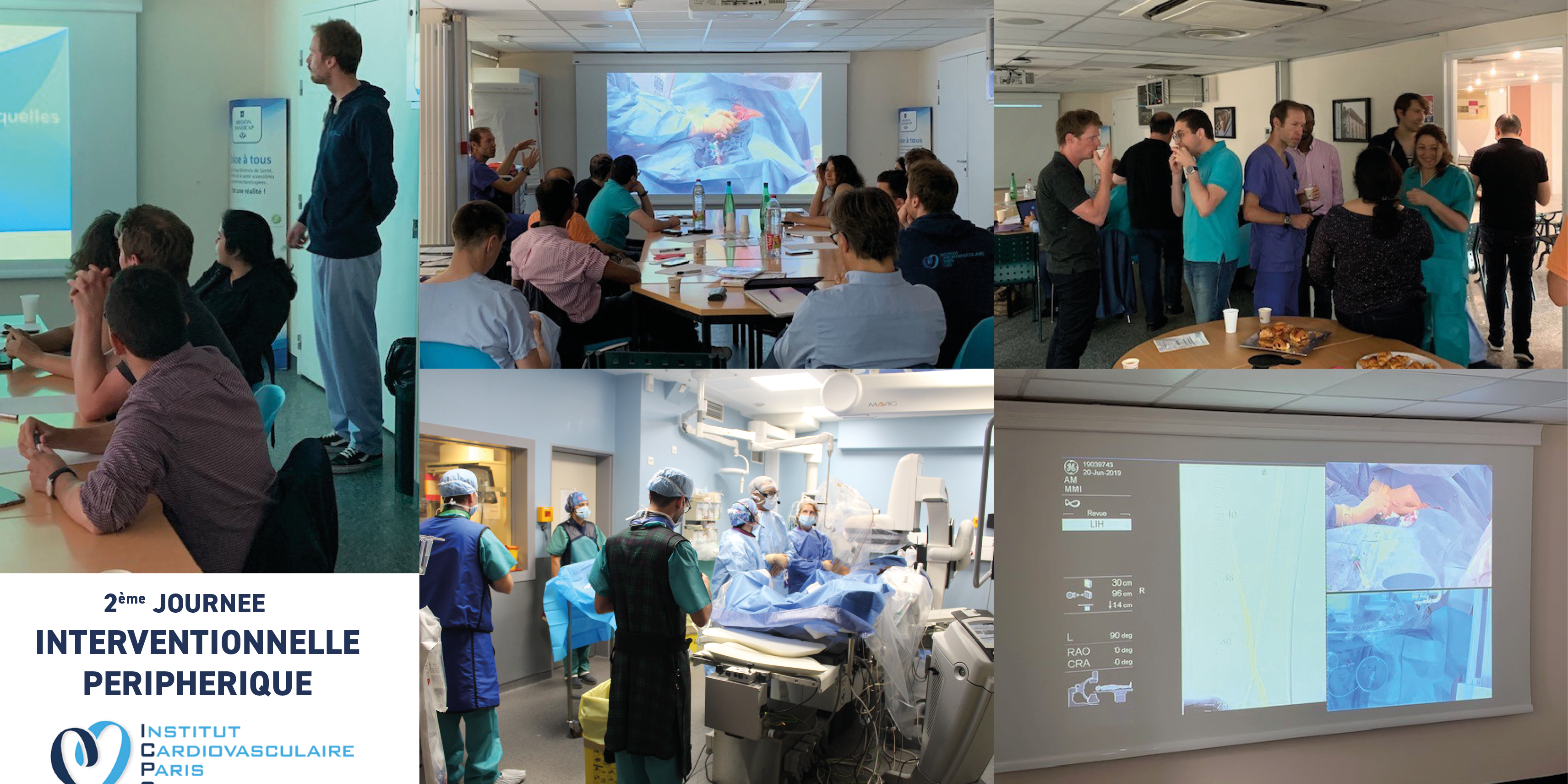 Interventionnel périphérique periphérique interventionnel