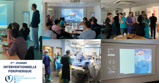 periphérique interventionnel