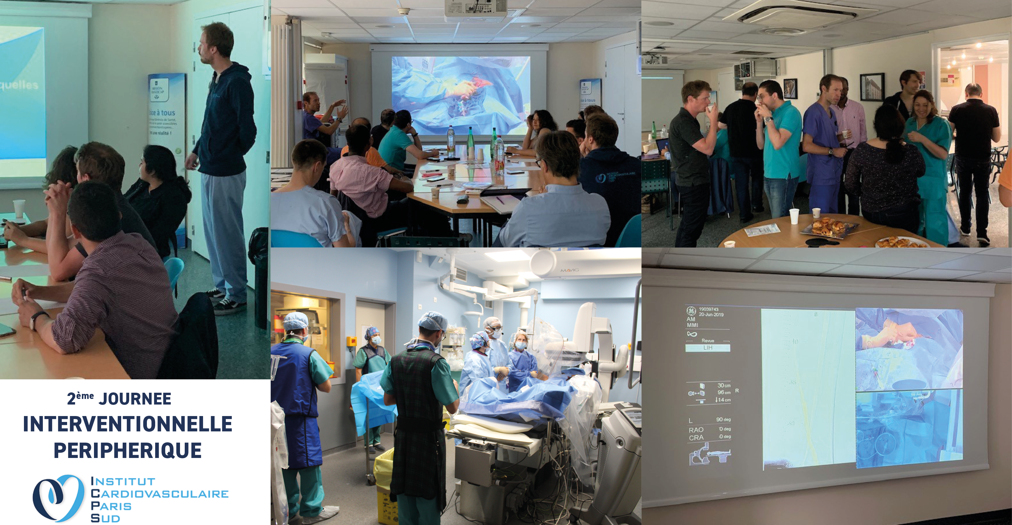 periphérique interventionnel