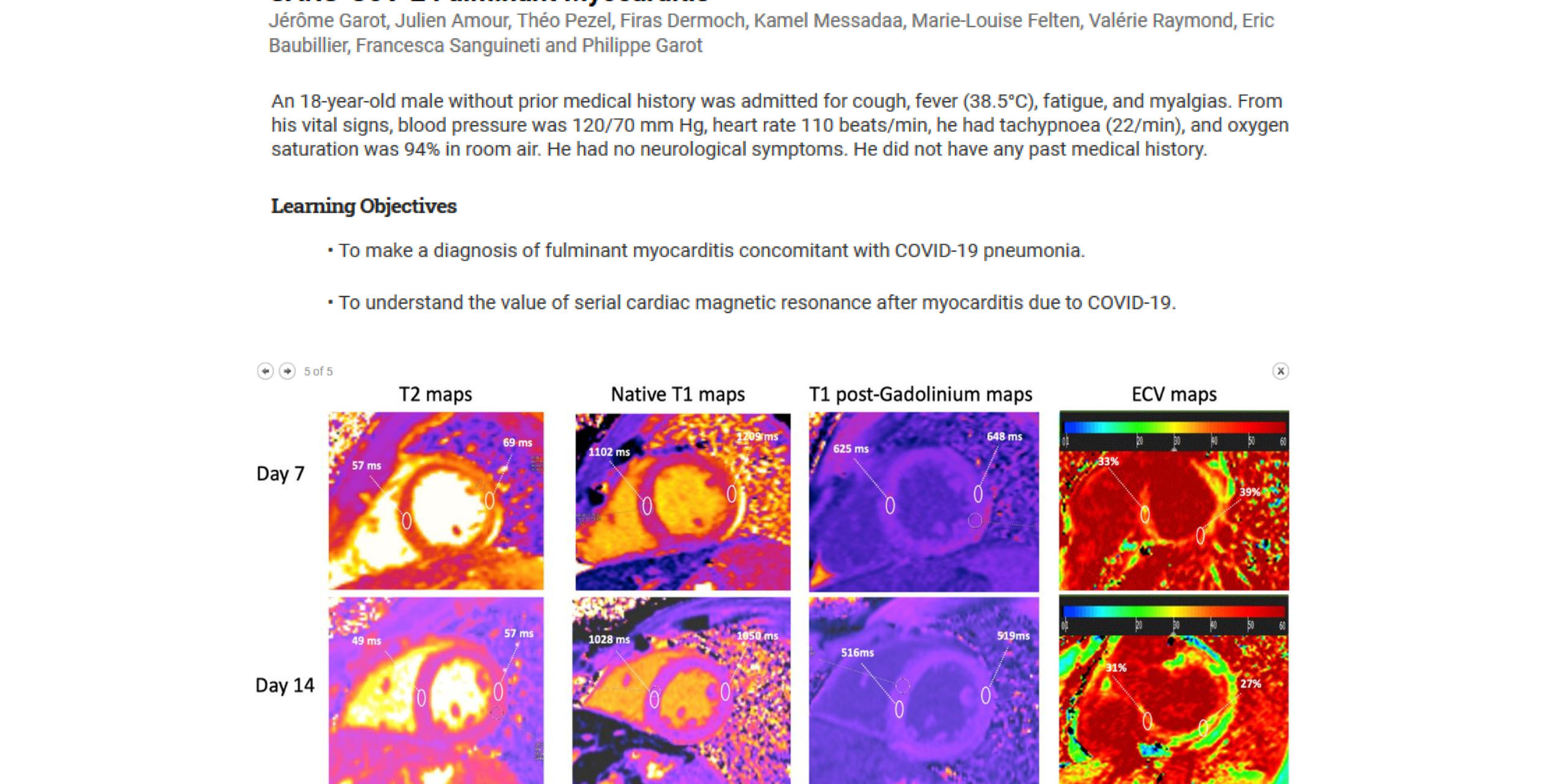 jacc journals article site internet JACC journals article