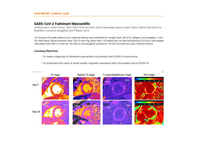 JACC journals article