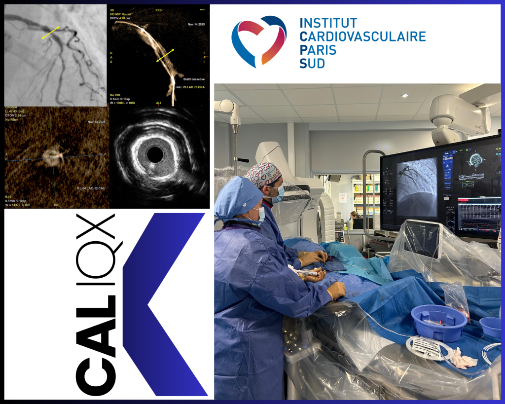 CALIQX trial, first patient included