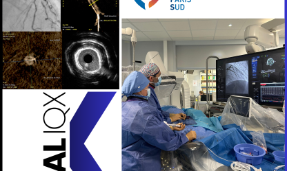 CALIQX trial, first patient included