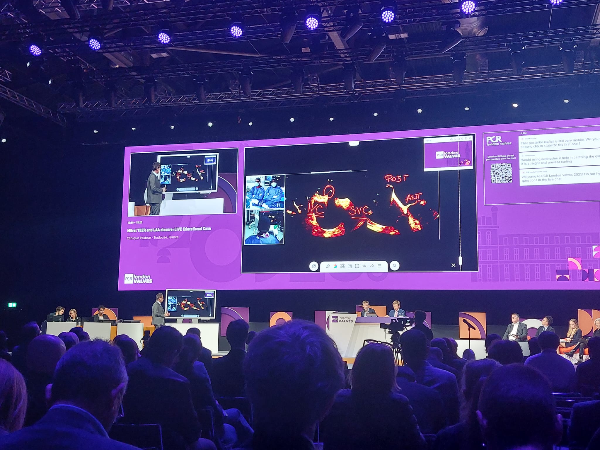 Dr Philippe Garot, London Valves 2025